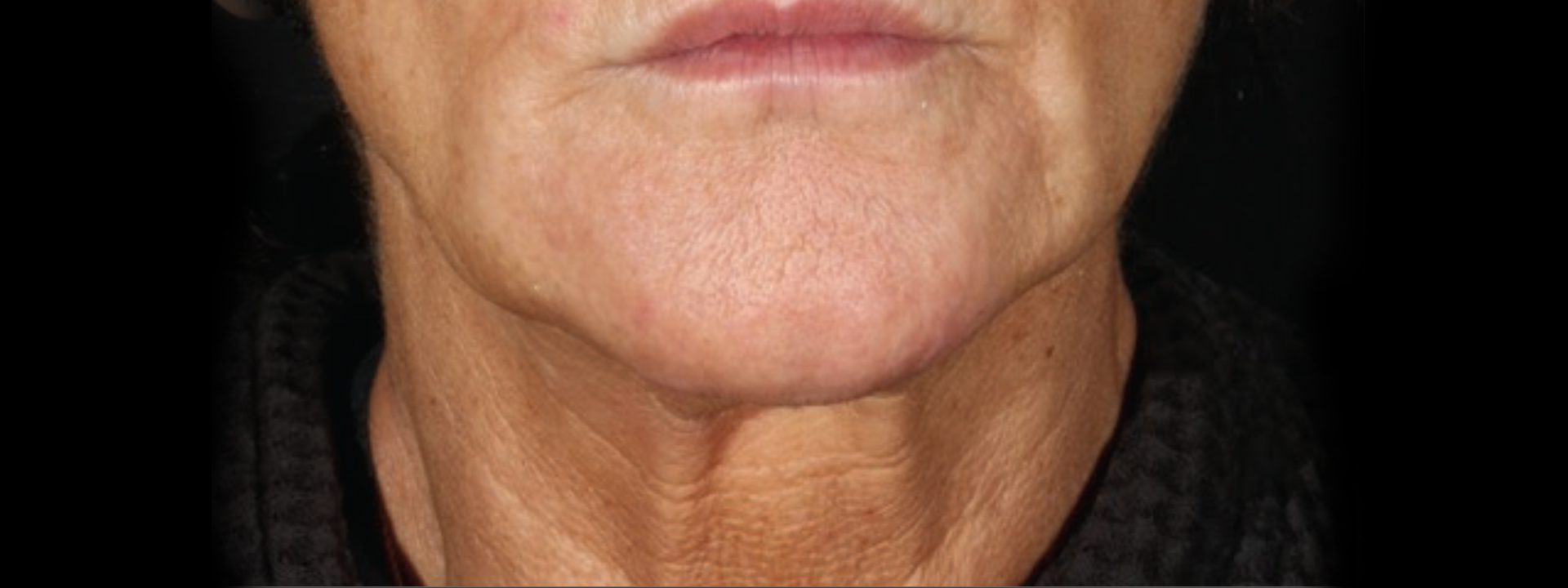 1920x720_after2tx_quibell