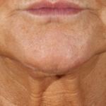 1920x720_before_quibell