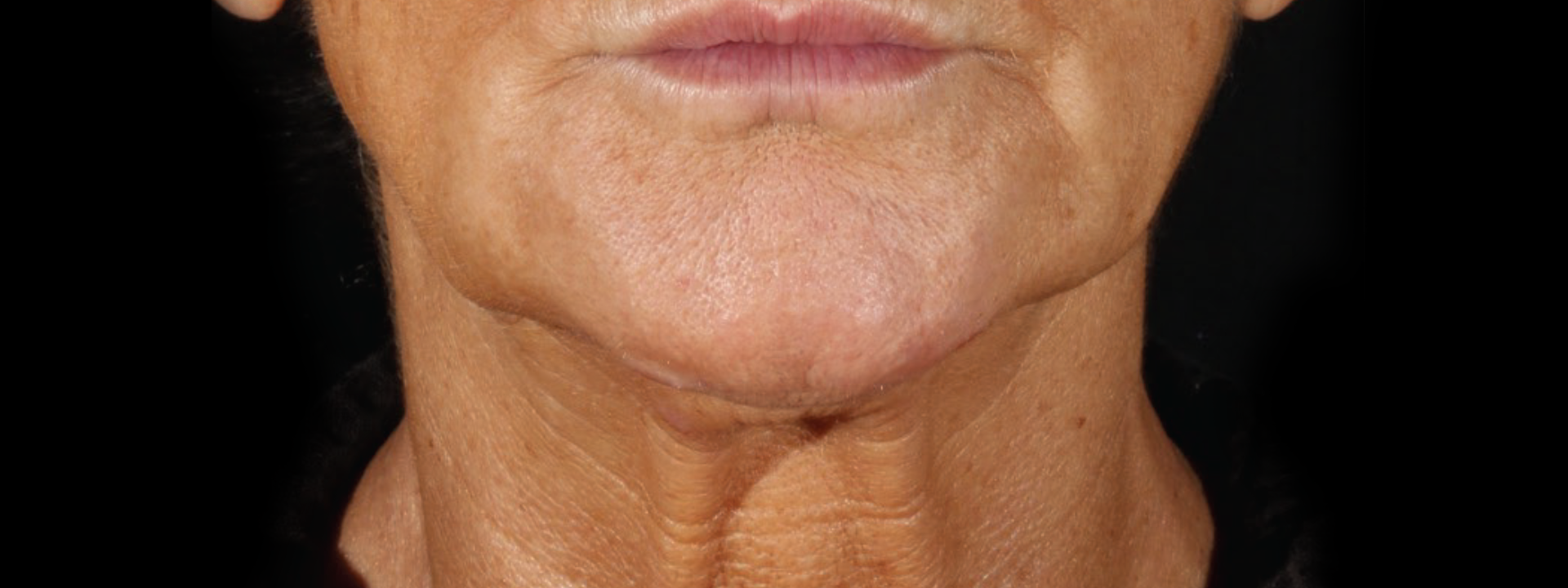 1920x720_before_quibell