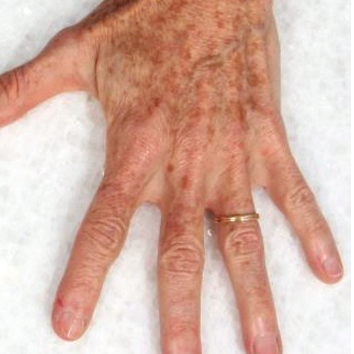 eco2-3d-melanie-palm-before