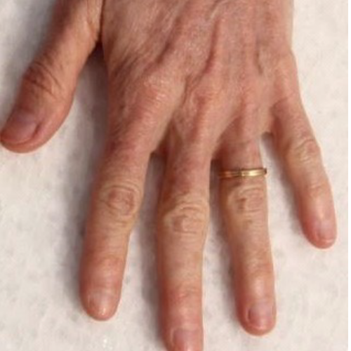 eco2-3d-melanie-palm-after