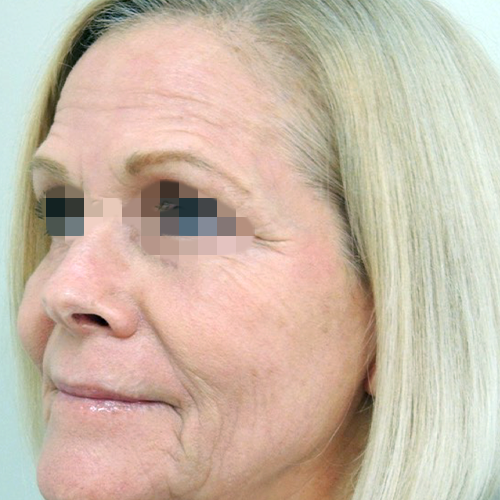 eco2-3d-zena-gabriel-after-1