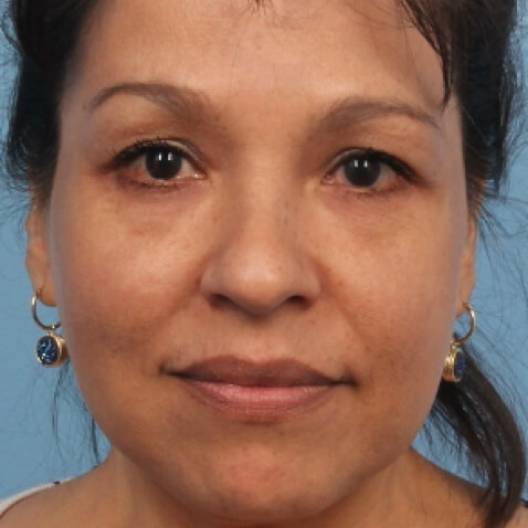 hollywood_spectra_2_after