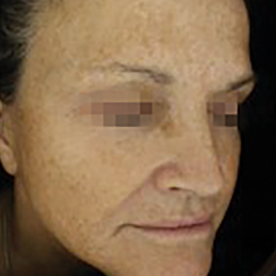 prd-1960-dermav-bnas-webformat-560x560-05