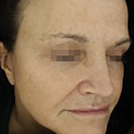 prd-1960-dermav-bnas-webformat-560x560-06