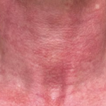 prd-1960-dermav-bnas-webformat-560x560-07