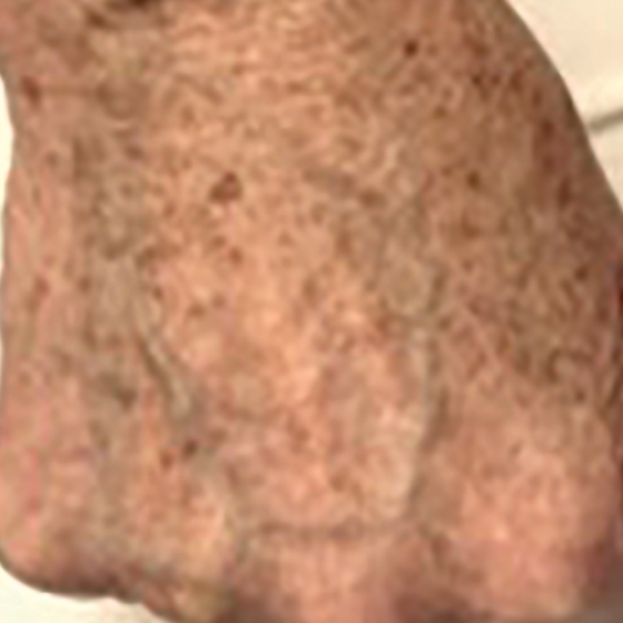 prd-1960-dermav-bnas-webformat-560x560-11