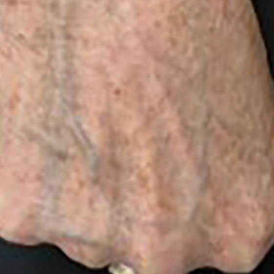 prd-1960-dermav-bnas-webformat-560x560-12