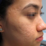 prd-1960-genius-bnas-webformat-560x560-01