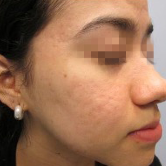 prd-1960-genius-bnas-webformat-560x560-02