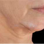 prd-1960-genius-bnas-webformat-560x560-05