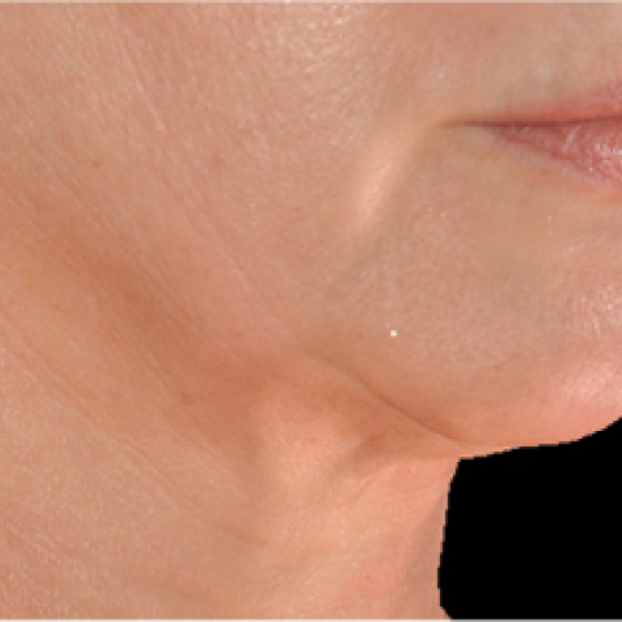 prd-1960-genius-bnas-webformat-560x560-06