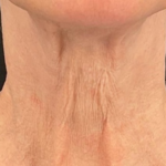 prd-1960-genius-bnas-webformat-560x560-11