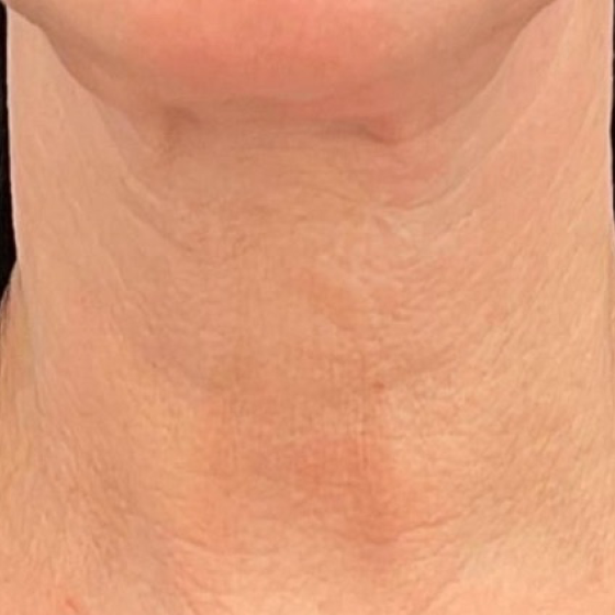 prd-1960-genius-bnas-webformat-560x560-12