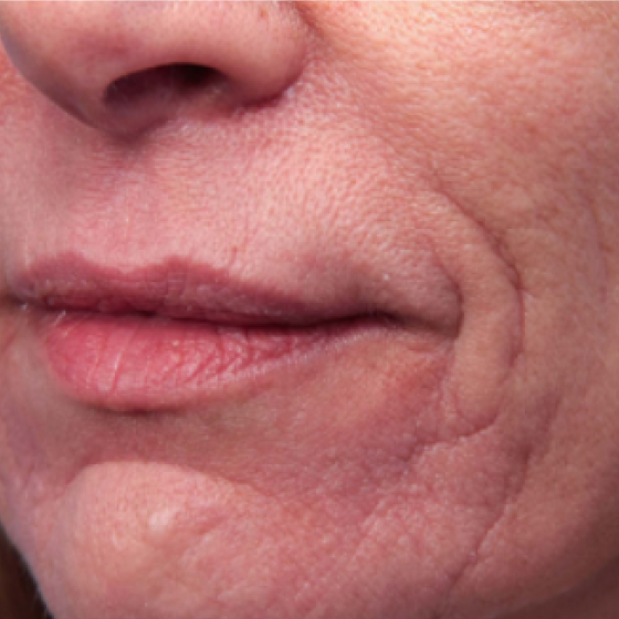 prd-1960-genius-bnas-webformat-560x560-13