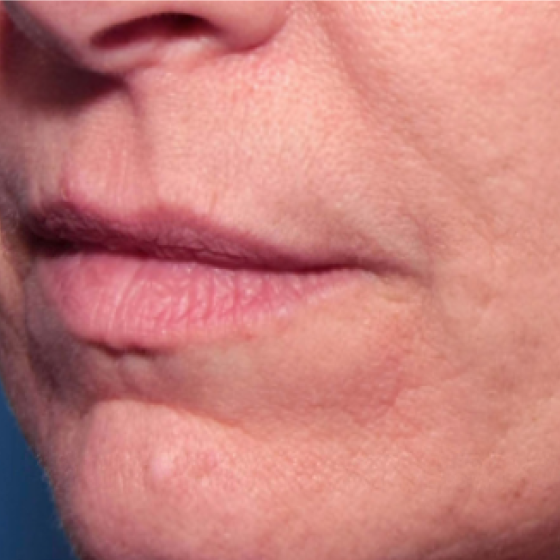 prd-1960-genius-bnas-webformat-560x560-14