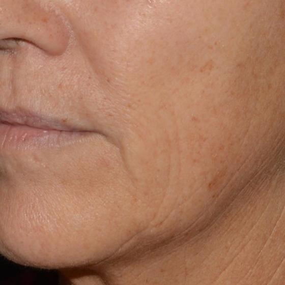 prd-1960-ultra-bnas-webformat-560x560-01