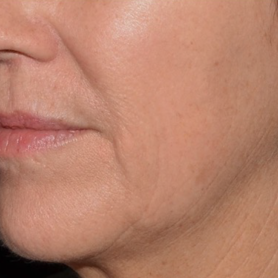 prd-1960-ultra-bnas-webformat-560x560-02