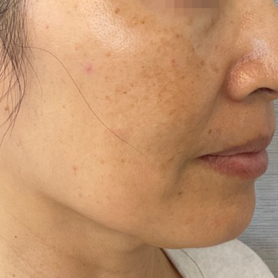 prd-1960-ultra-bnas-webformat-560x560-05