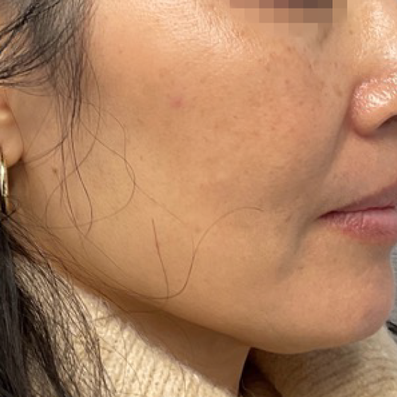 prd-1960-ultra-bnas-webformat-560x560-06