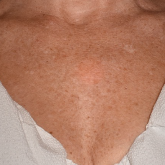 prd-1960-ultra-bnas-webformat-560x560-07