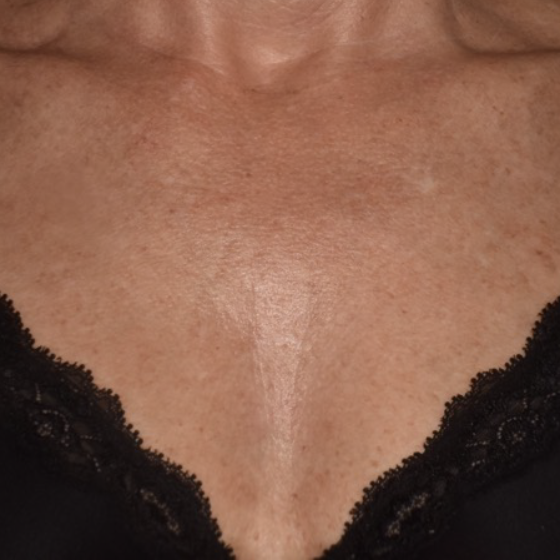 prd-1960-ultra-bnas-webformat-560x560-08