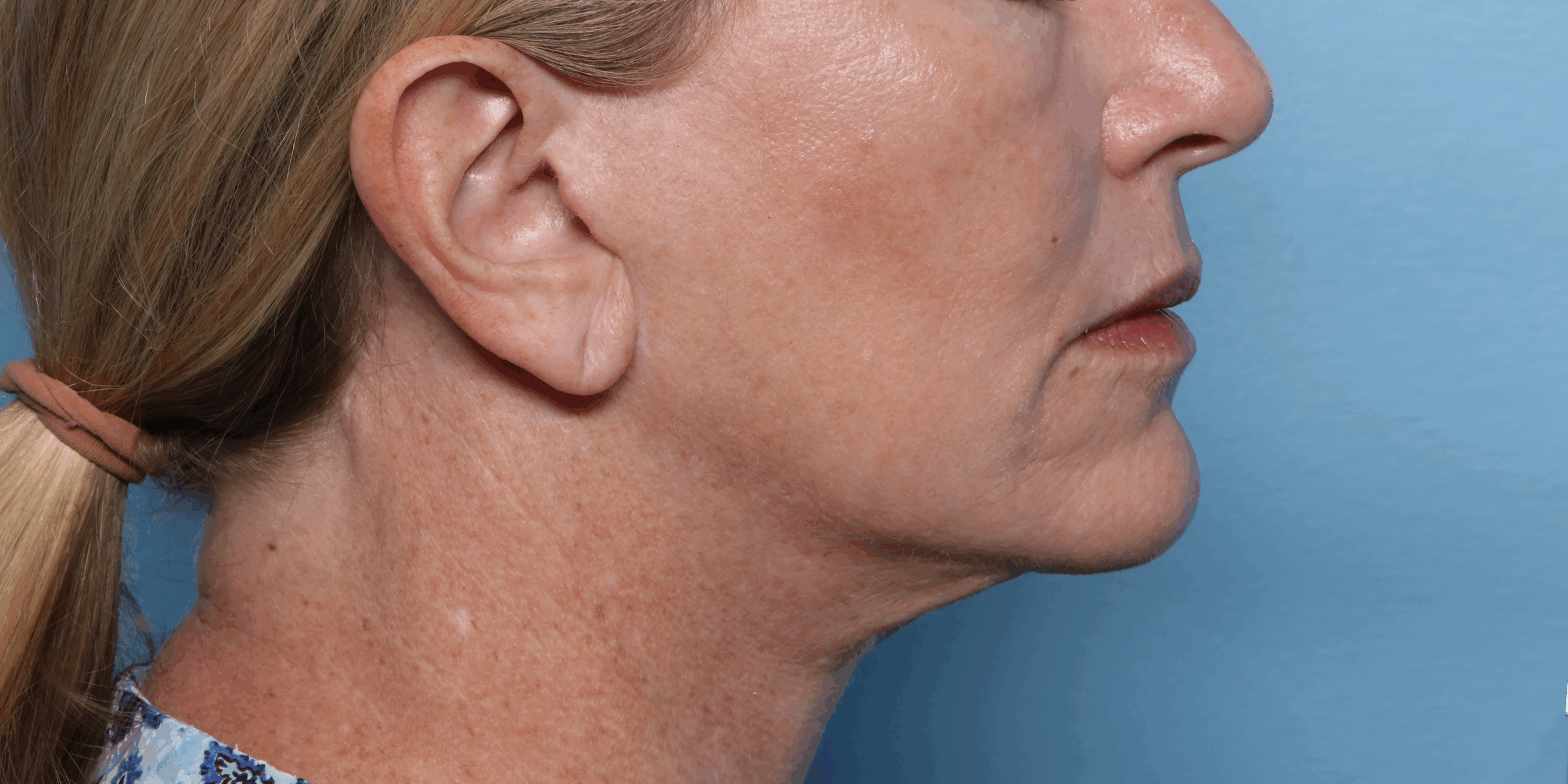 wang-xerf-after-scaled-1