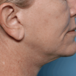 wang-xerf-before-scaled-1