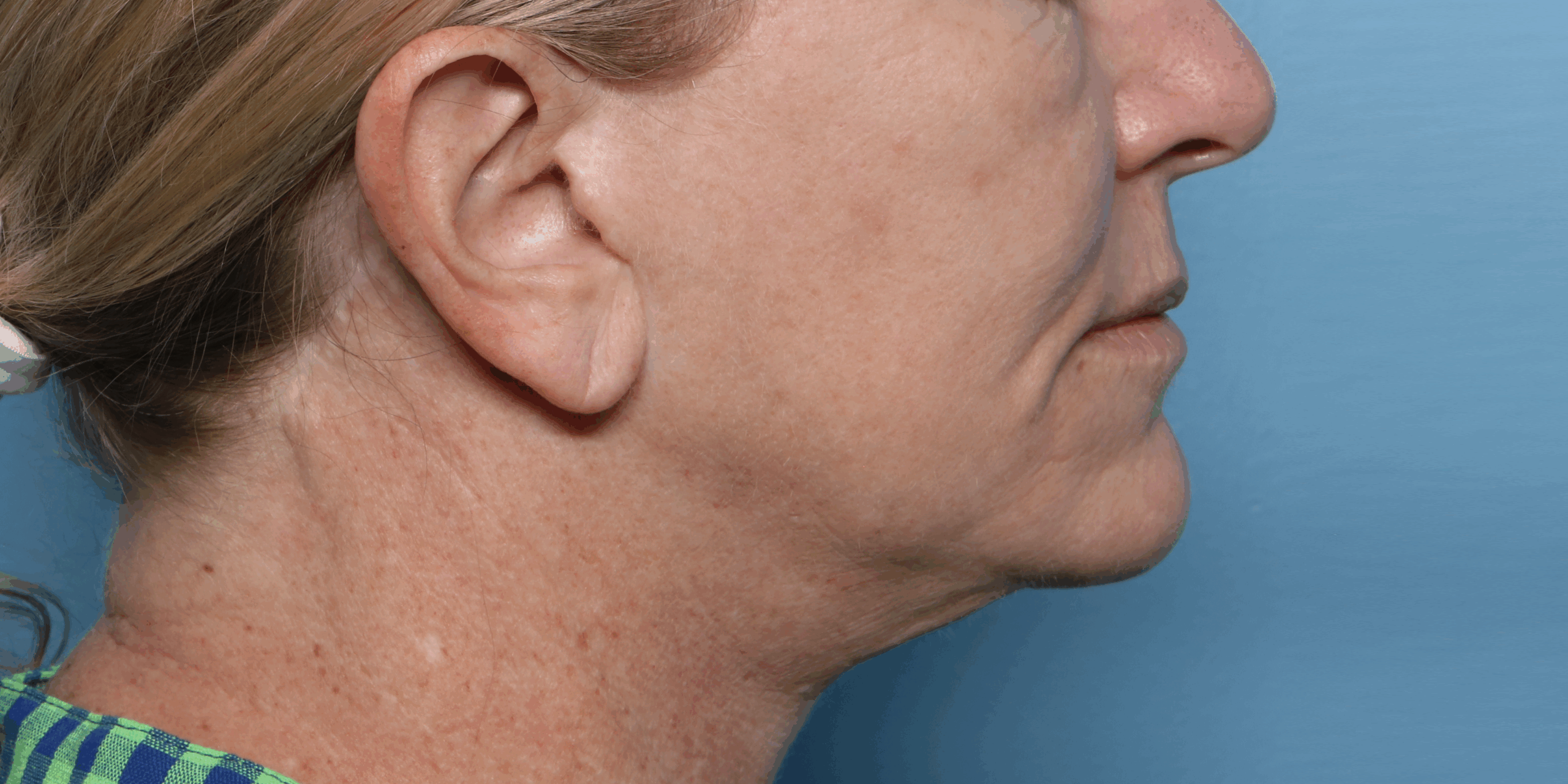 wang-xerf-before-scaled-1