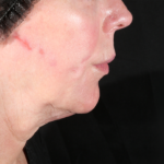 xerf-quibell-before-1