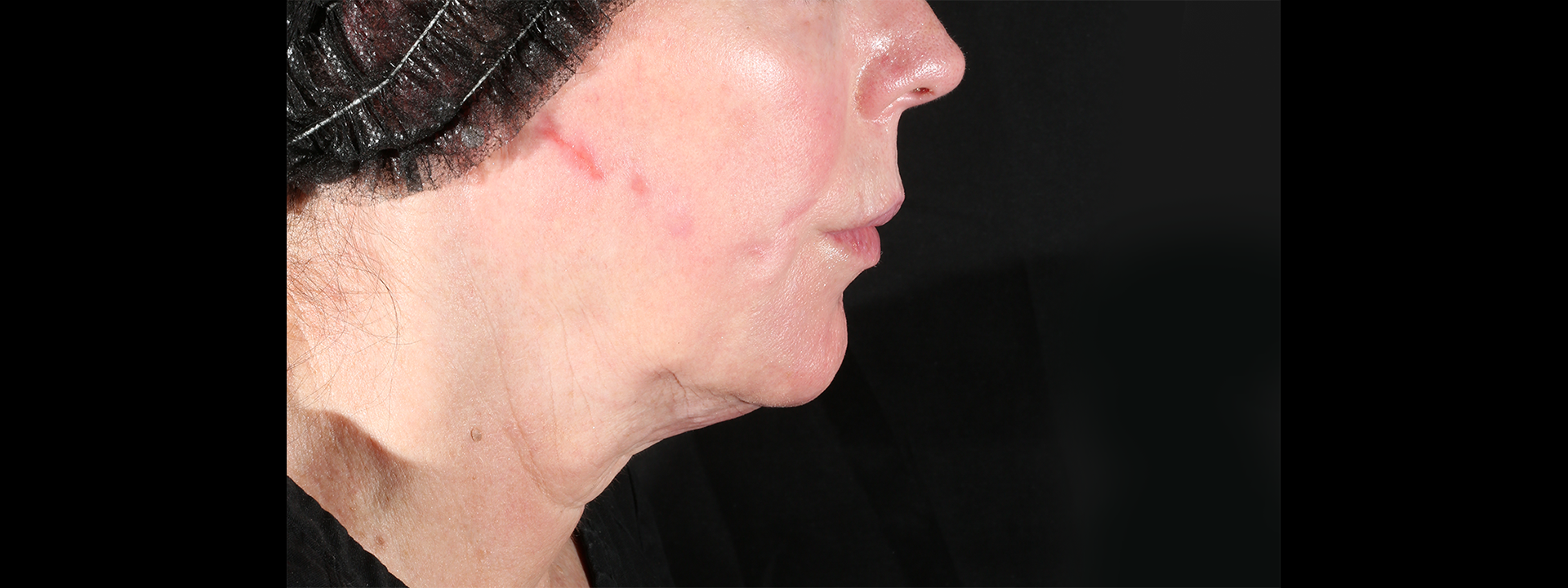 xerf-quibell-before-1